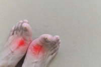 Who Is Vulnerable to Developing Gout?
