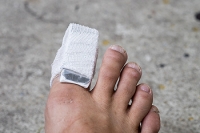 What to Expect If You Have Broken Your Toe