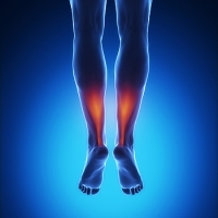 All About Achilles Tendon Injuries